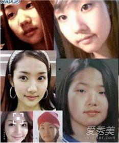 哪些明星整容最多,揭秘整容最多的明星